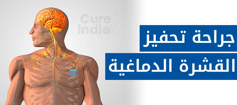 علاج تحفيز الدماغ البشري كهربائيا في الهند